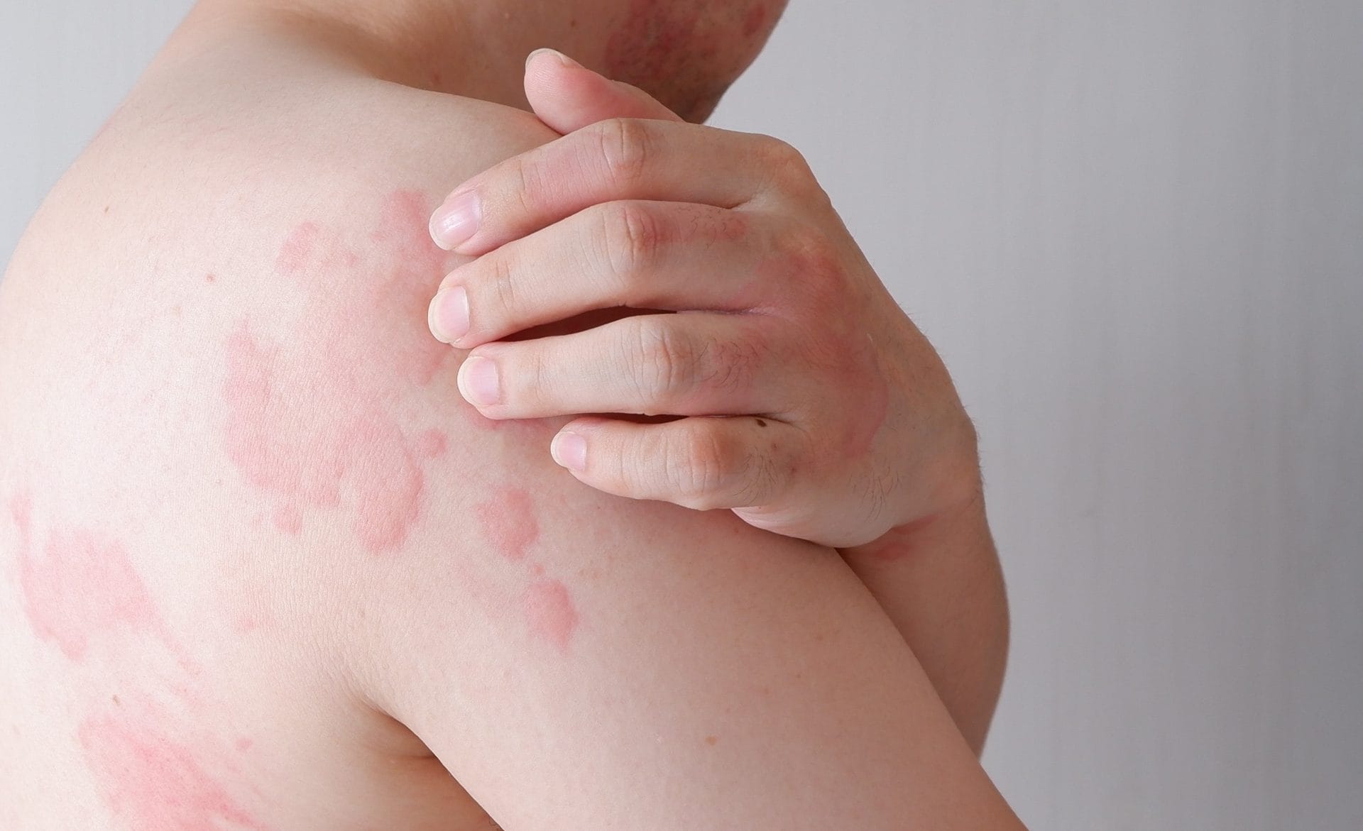Skin Diseases | Birmingham Dermatology Associates